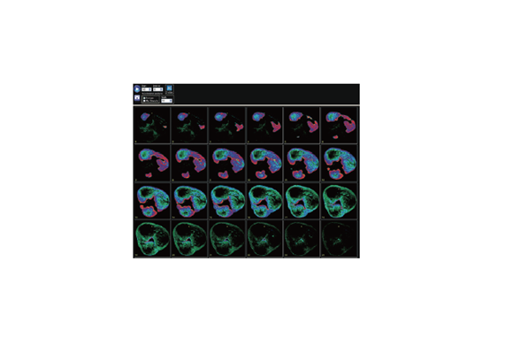 3D OCT 分析軟件Multi Slice Viewer